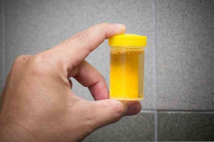 Berapa Lama Ubat Ubatan Biasanya Bertahan Dalam Darah Dan Air Kencing Maklumat Kesihatan Petua Perubatan Dan Maklumat Kesihatan Yang Berguna